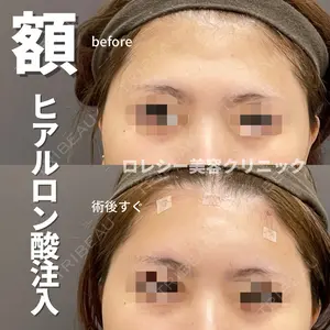 ロレシー美容クリニック 心斎橋駅前院 福留院長医師の症例