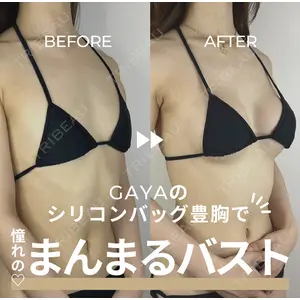 GAYA body design clinicの症例