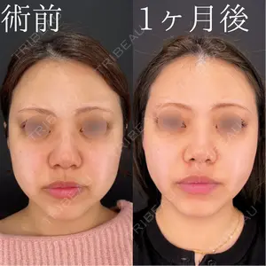 HAAB×DREAM BEAUTY CLINIC 大阪梅田院 鈴木 馨斗医師の症例