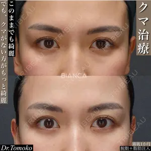 BIANCA銀座の症例