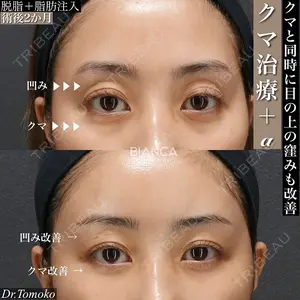 BIANCA銀座の症例