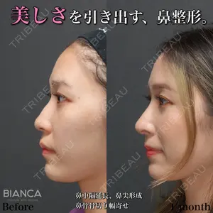 BIANCA銀座 新行内 芳明医師の症例