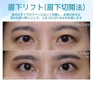 聖心美容クリニック 札幌院の症例