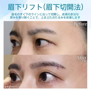 聖心美容クリニック 札幌院の症例