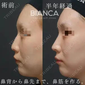 BIANCA銀座 中尾 崇医師の症例