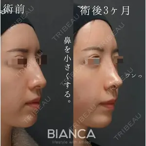 BIANCA銀座 中尾 崇医師の症例