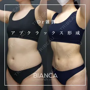 BIANCA銀座 雜賀 俊行医師の症例