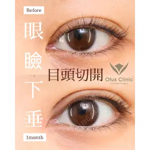 Otus Clinic 【オータスクリニック】 中 徳太郎医師の症例