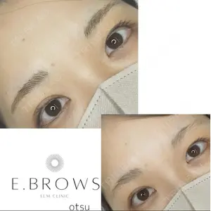 美容皮膚科エルムクリニック 福岡院の症例