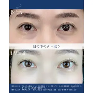 AI Beauty Clinic （エーアイ美容クリニック） 尾崎 宥文医師の症例