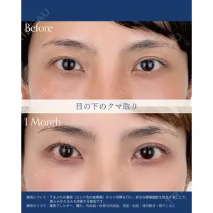 AI Beauty Clinic （エーアイ美容クリニック） 尾崎 宥文医師の症例