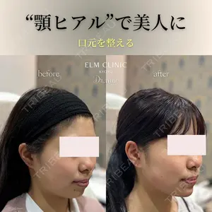 美容皮膚科エルムクリニック 福岡院の症例