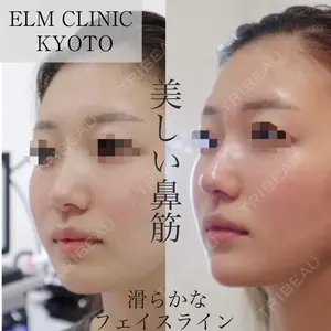 美容皮膚科エルムクリニック 京都院 内山 雄一朗医師の症例