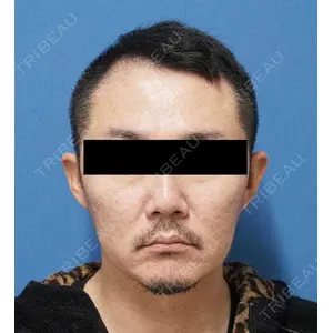 もとび美容外科クリニック 新宿院 西尾 謙三郎医師の症例