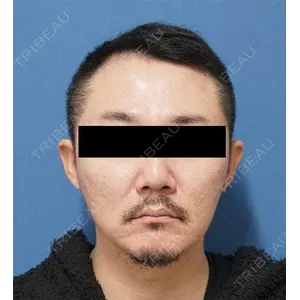もとび美容外科クリニック 新宿院 西尾 謙三郎医師の症例