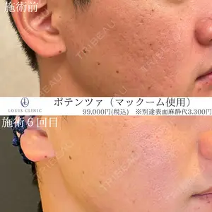 LOUIS CLINIC 二子玉川院【ルイクリニック】 小松 塁医師の症例