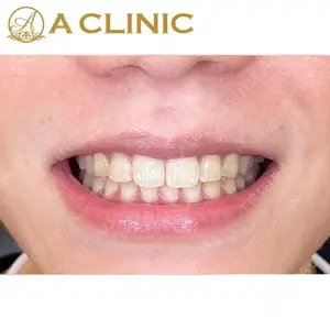A CLINIC（エークリニック） デンタル 銀座の症例