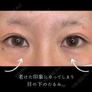 ルラ美容クリニック 札幌大通り院の症例