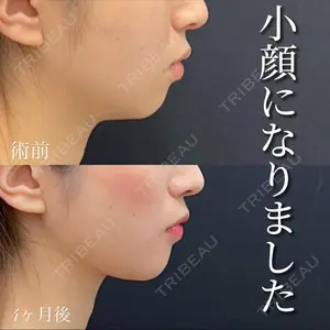 湘南美容クリニック 銀座院の症例