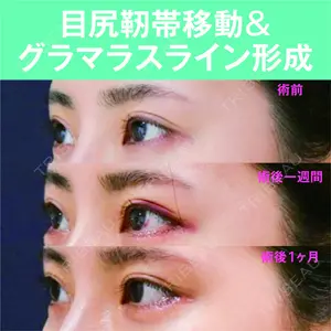 S.T styleクリニック 徳田 真紀子医師の症例