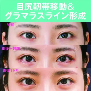 S.T styleクリニック 徳田 真紀子医師の症例