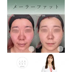 くさのたろうクリニック 立雅恵医師の症例