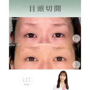 くさのたろうクリニック 立雅恵医師の症例