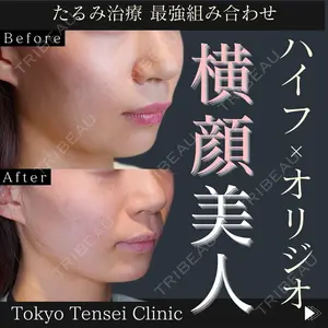 Tokyo Tensei Clinic 新宿院 辻 大成医師の症例