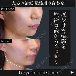Tokyo Tensei Clinic 新宿院 辻 大成医師の症例