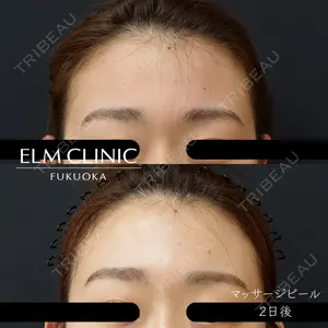 美容皮膚科エルムクリニック 福岡院 エルムクリニック福岡院看護師医師の症例