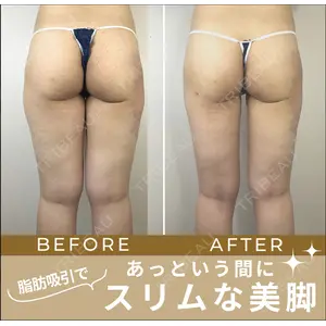 GAYA body design clinic 飯ヶ谷 重来医師の症例