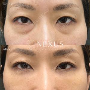NEXUS CLINICの症例