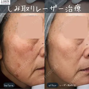 Jスキンクリニック 【J-SKIN clinic】の症例