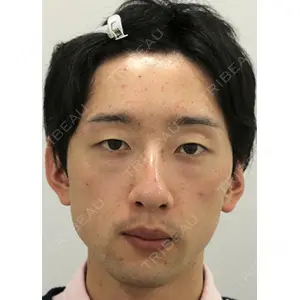 セオリークリニック 筒井　裕介医師の症例