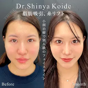東京シンデレラ美容外科 池袋院の症例