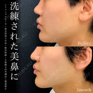 東京シンデレラ美容外科 池袋院 小出 真哉医師の症例