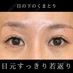 ルラ美容クリニック 札幌大通り院の症例
