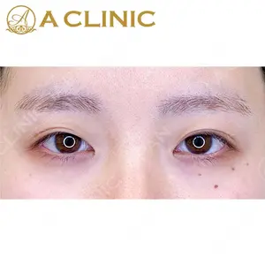 A CLINIC（エークリニック） 大阪院 田窪 賢志郎医師の症例