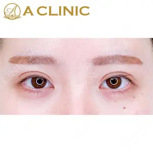A CLINIC（エークリニック） 大阪院 田窪 賢志郎医師の症例