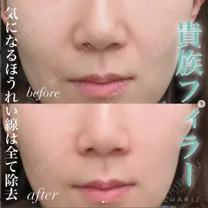 CHARIS BEAUTY CLINICの症例