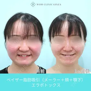 WOM CLINIC GINZA （ワム クリニック ギンザ） 深堀 純也医師の症例