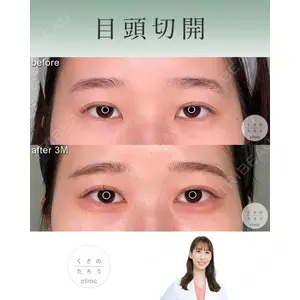 くさのたろうクリニック 立雅恵医師の症例