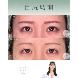 くさのたろうクリニック 立雅恵医師の症例