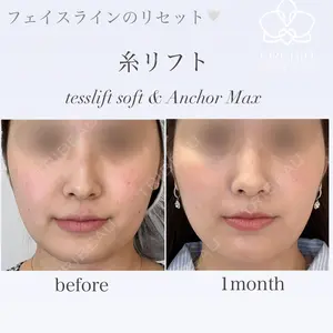 オーキッド美容クリニック東京御徒町 西浦 蘭子医師の症例