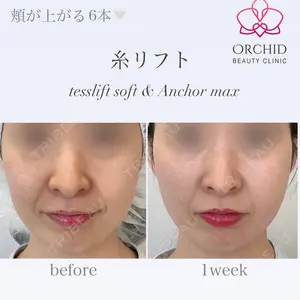 オーキッド美容クリニック東京御徒町 西浦 蘭子医師の症例