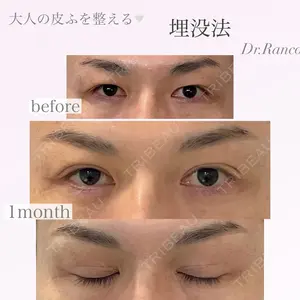 オーキッド美容クリニック東京御徒町 西浦 蘭子医師の症例