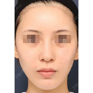 プリモ麻布十番クリニック 大場教弘医師の症例
