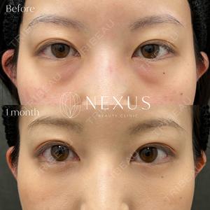 NEXUS CLINICの症例