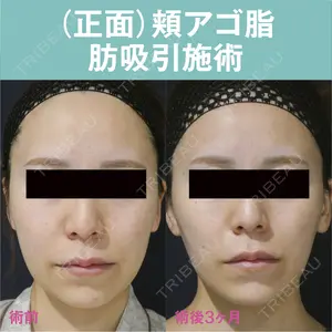 S.T styleクリニック 徳田 真紀子医師の症例