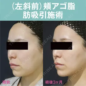 S.T styleクリニック 徳田 真紀子医師の症例